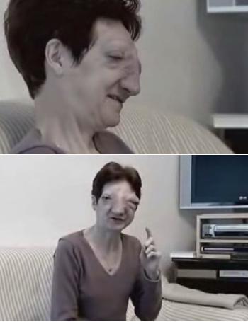 [동영상] 佛희귀병 환자 “안락사 시켜달라” 논란