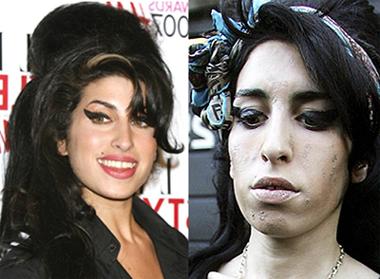 “내 모습 돌려줘”…피부병 걸린 와인하우스