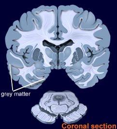 “동성애자는 뇌 구조가 다르다” 연구 발표