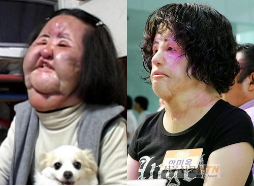 선풍기 아줌마 “제 얼굴 많이 달라졌나요?”
