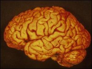 美연구팀 “잘사는집 아이가 더 똑똑하다”