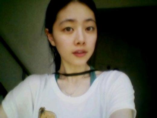 홍수아, 알고보니 ‘허리디스크’…”너무 말랐어”