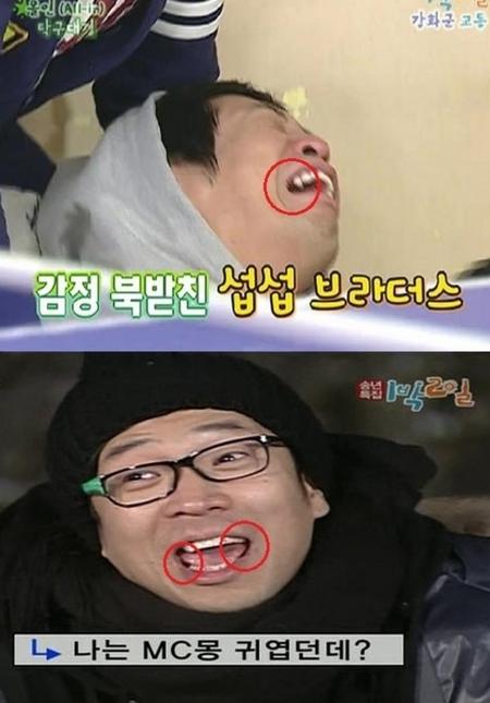 ‘병역 기피의혹’ MC몽, 치아상태 확인 ‘경악’
