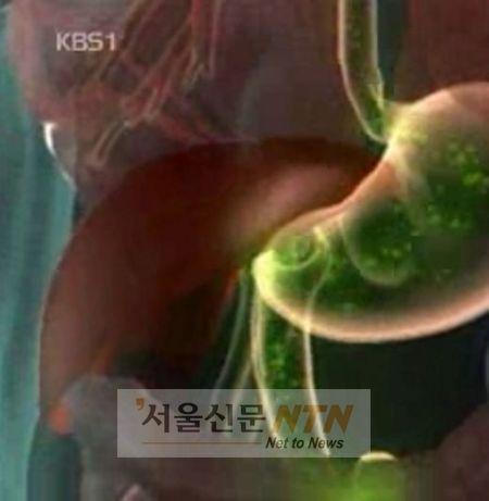 한국 암사망률, 아시아 최고 수준…北,日보다 높아