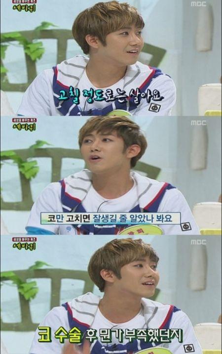 광희 성형부작용 실토 “어머니 추천받았는데 머리아파”