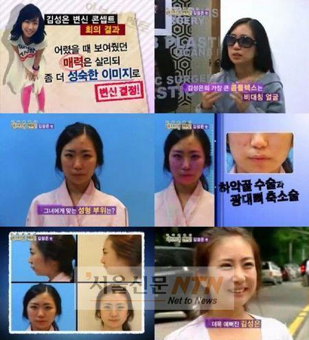 김성은 성형 공개...”왜 했니VS잘했다” 네티즌 설전중