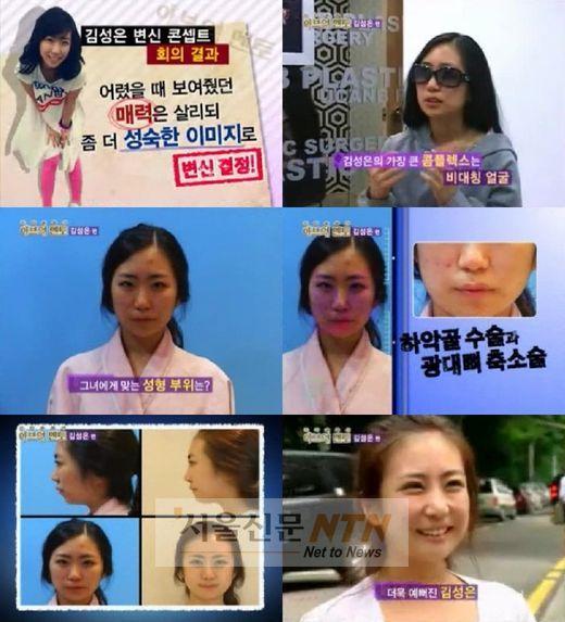 김성은, 9시간 성형수술 반응냉담 “연기로 극복해라”