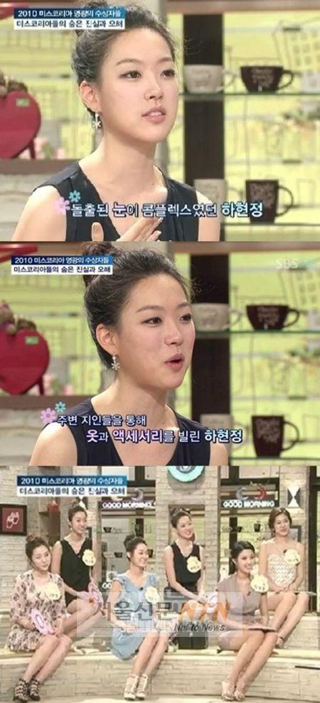 하현정 눈 성형고백 “돌출 눈 콤플렉스, 살짝…”