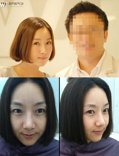 김지혜, ‘훈남 된’ 임혁필 따라 양악수술…“변신성공”