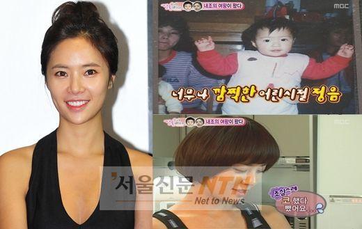 ‘지금은 자연미인’ 황정음 “코에 실리콘 넣다→뺐다”