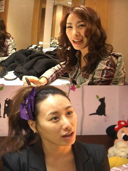 김소향, 임혁필-김지혜 이어 공개 양악수술