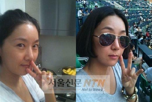 김지혜, ‘양악수술 후’ 셀카…“할머니 얼굴 같아”