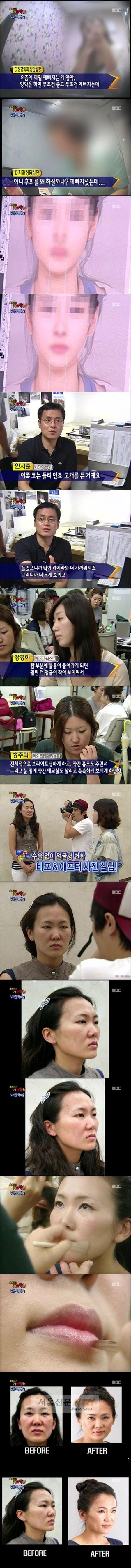 ‘양악수술’ 수술전후 사진조작…‘포토샵-화장발 고발’