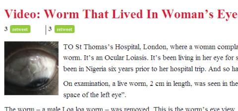 눈에서 살아있는 ‘12cm 기생충’ 나와