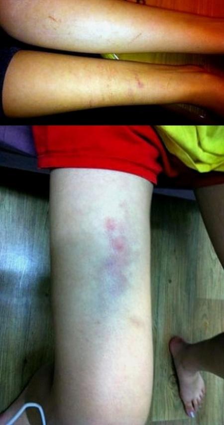 김미리내, 이상구 폭행사진 공개 “너무 뻔뻔…어리다고 무시?”