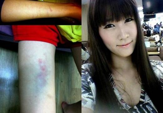 김미리내, 이상구 폭행증거사진 공개…‘왜?’