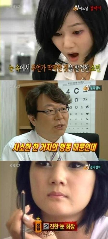 스모키 눈화장, ‘결막결석’ 가장 큰 원인…대책은?