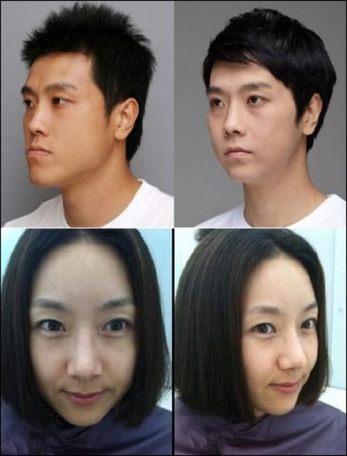 이동윤vs김지혜 … 양악수술로 페이스오프 개그맨은?