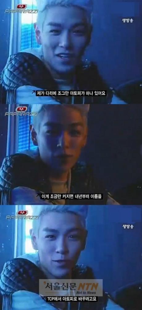 탑, ‘아토피’ 신체비밀 깜짝 공개
