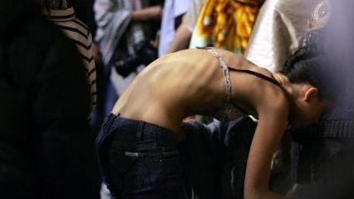 “너무 말라도 결장암 걸릴 확률 높아진다”