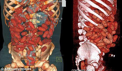 2억원대 마약 삼킨 ‘엽기’ 밀수범 체포