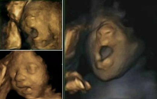 엄마 뱃속서 하품하는 태아 ‘생생 포착’