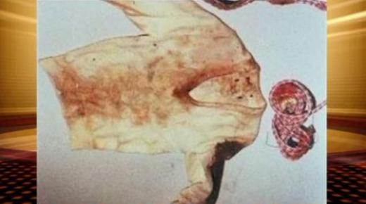 [미주통신] 30년 전 성폭행 피살 소녀 무덤 발굴, “범인 밝혀질까?”