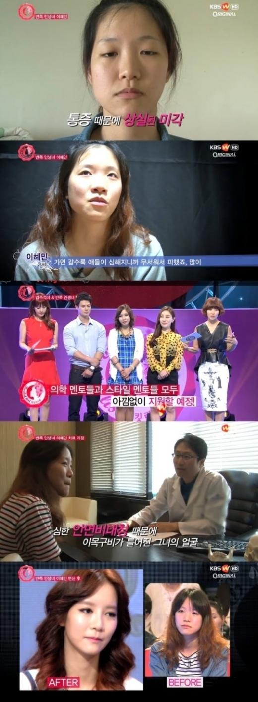 ‘반쪽인생녀’ 뒤틀린 얼굴 그녀, 바뀐 미모가 ‘헉’