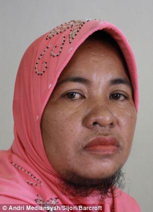 덥수룩한 ‘턱수염’ 가진 여인의 안타까운 사연