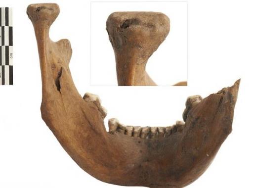 고대 영국에 ‘글래디에이터’가? 참수 해골 39개 발견