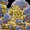 유방암 유발 ‘특정 유전자’ 발견…新치료법 기대