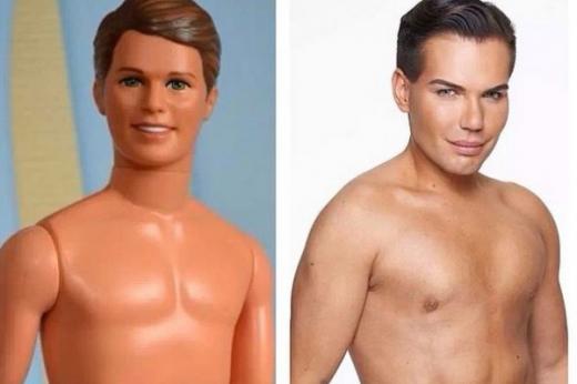 ‘남자 바비’ 되려…1억여원 쓴 성형중독男 화제