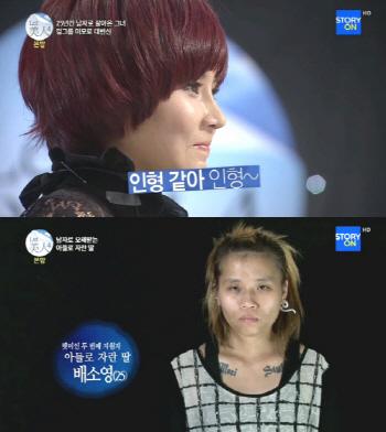 애프터플러스, 렛미인4 성형 붓기 없는 완벽 변신 지원!