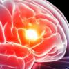 美연구진, 인간 뇌 속 ‘on-off’ 스위치 최초 발견
