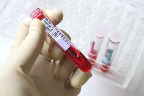 “혈액 검사만으로 자살 가능성 예측 가능” (존스홉킨스大)