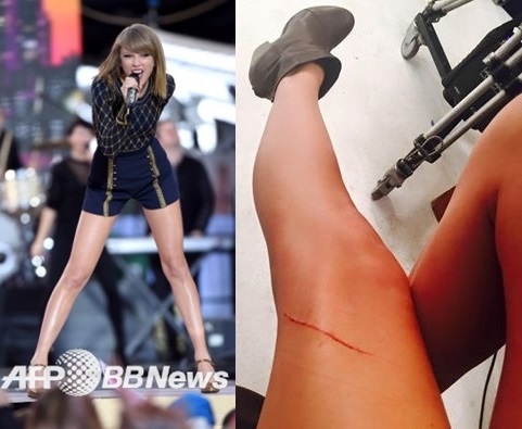 테일러 스위프트, “4000만달러 보험든 다리...고양이가 발톱으로...”