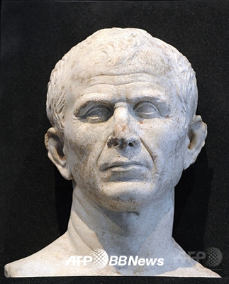 “시저, 간질 아닌 ‘미니 뇌졸중’ 앓아”