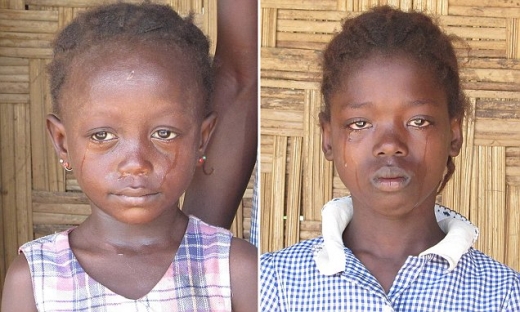 [나우! 지구촌] “돌아봐주세요” 에볼라가 남긴 고아들, 굶주림에 죽음·성매매