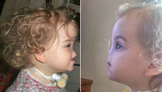 “나도 ‘코’가 생겼어요...앞으로 더 예뻐질거래요”