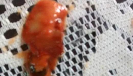 토마토소스에 절인 사람 손가락? 충격