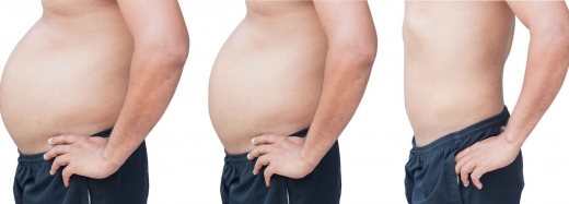 한번 찐 살은 안 빠진다...78%가 5년내 다시 쪄