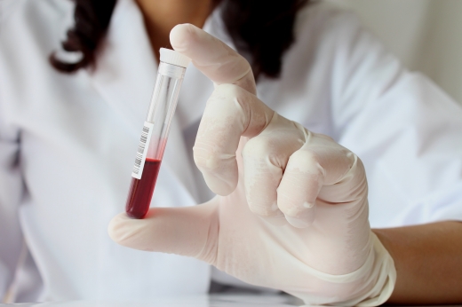 [건강을 부탁해] 피 한방울로 ‘노화 속도’ 예측한다