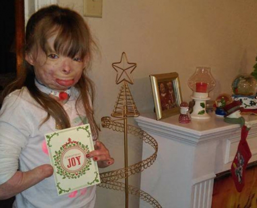 화마에 가족 잃고 상처입은 소녀…전 세계서 성탄카드 쇄도 감동