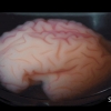 호두 닮은 뇌 주름, 생성 원리 밝혔다…네이처 게재