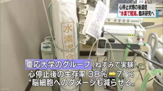 수소로 심정지환자 뇌손상 완화…日서 임상시험 시작