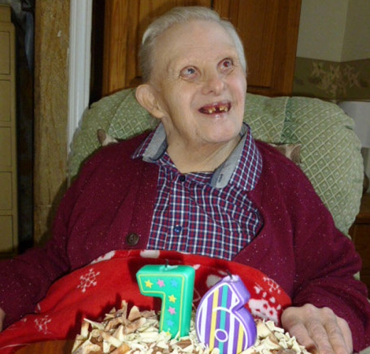 최고령 다운증후군 환자, 76번째 생일 축하 화제