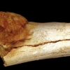 200만년 전 인류도 암에 걸려…뼈에서 악성종양 발견