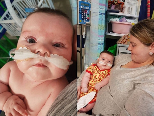 뇌척수막염 아기…“며칠 못 살 것” 의료진 예상 넘어 기적