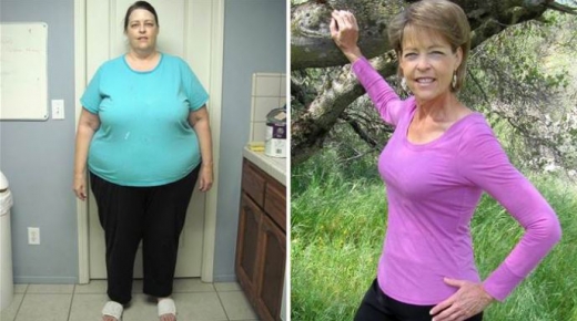 102kg 감량한 63세 여성이 알려주는 다이어트 비법
