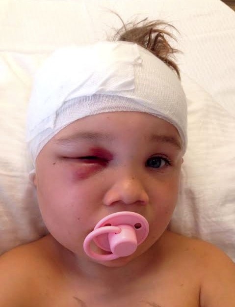 3살 머리에 떨어진 대형스피커…목숨은 건졌지만